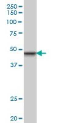 Western Blot: SNF5 Antibody (3E10) [H00006598-M01]