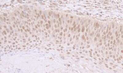 Immunohistochemistry: SNF5 Antibody [NB100-57525]