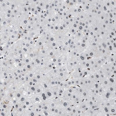Immunohistochemistry-Paraffin: SNF5 Antibody [NBP1-90013]