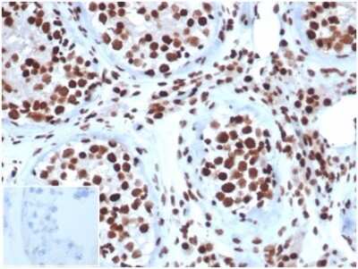 Immunohistochemistry-Paraffin: SNF5 Antibody (SMARCB1/3984) [NBP3-13774]