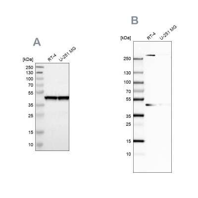 Western Blot: SNF5 Antibody [NBP1-90013]