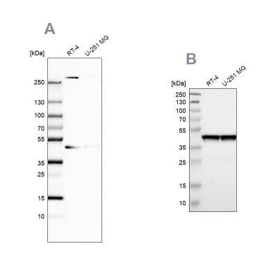 Western Blot: SNF5 Antibody [NBP1-90014]