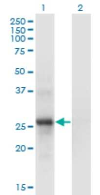 Western Blot: SNF8 Antibody (6B11) [H00011267-M01]