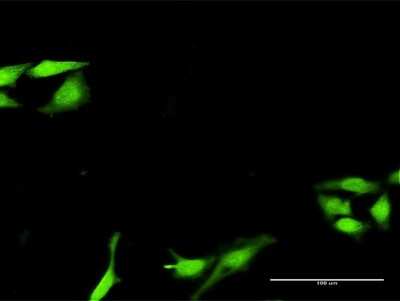 Immunocytochemistry/ Immunofluorescence: SNF8 Antibody [H00011267-D01P]