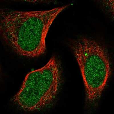 Immunocytochemistry/ Immunofluorescence: SNIP1 Antibody [NBP1-89428]