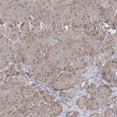Immunohistochemistry-Paraffin: SNIP1 Antibody [NBP1-89428]