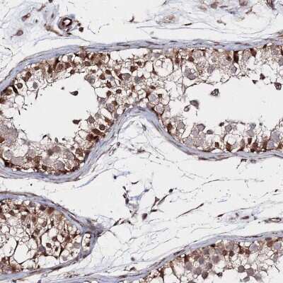 Immunohistochemistry-Paraffin: SNIP1 Antibody [NBP1-89428]