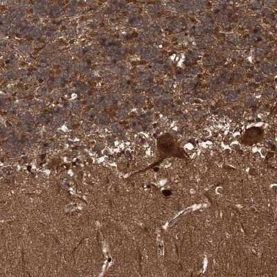 Immunohistochemistry-Paraffin: SNRNP25 Antibody [NBP2-31988]