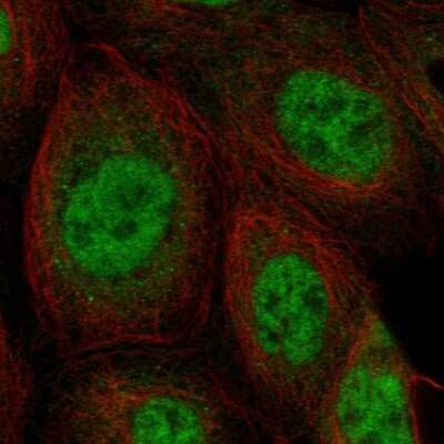 Immunocytochemistry/ Immunofluorescence: SNRNP27 Antibody [NBP1-80808]