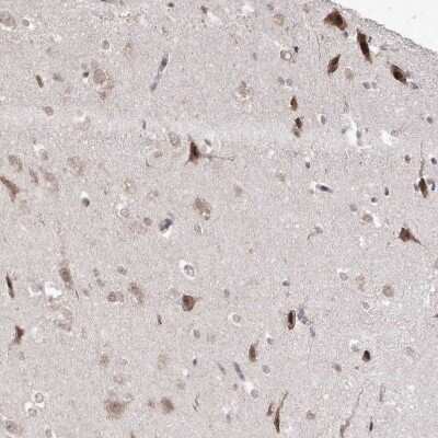 Immunohistochemistry-Paraffin: SNRNP27 Antibody [NBP1-80808]