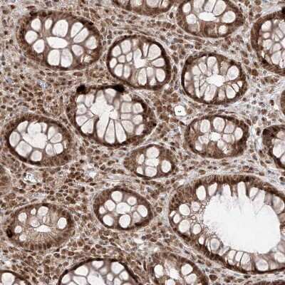 Immunohistochemistry-Paraffin: SNRNP27 Antibody [NBP1-80808]
