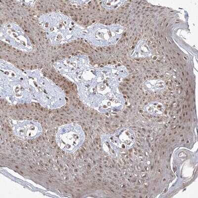 Immunohistochemistry-Paraffin: SNRNP27 Antibody [NBP1-80808]