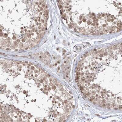 Immunohistochemistry-Paraffin: SNRNP27 Antibody [NBP1-80808]