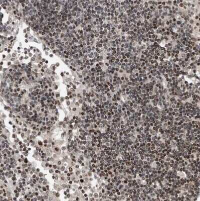 Immunohistochemistry-Paraffin: SNRNP48 Antibody [NBP1-86760]