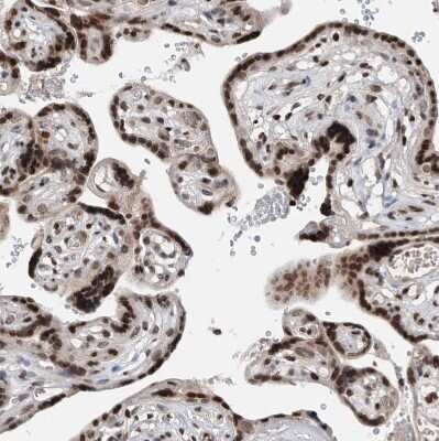 Immunohistochemistry-Paraffin: SNRNP48 Antibody [NBP1-86760]