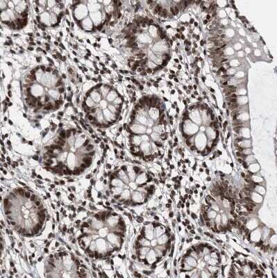 Immunohistochemistry-Paraffin: SNRNP48 Antibody [NBP1-86760]