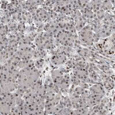 Immunohistochemistry-Paraffin: SNRNP48 Antibody [NBP1-86760]