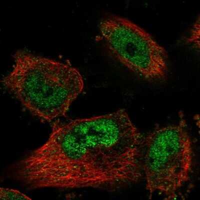 Immunocytochemistry/ Immunofluorescence: SNRP70 Antibody [NBP2-37896]