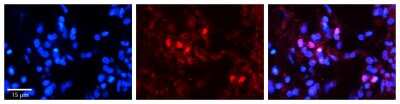 Immunohistochemistry: SNRP70 Antibody [NBP1-57455]