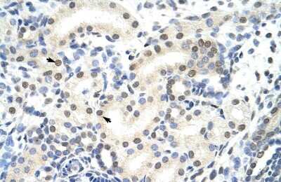 Immunohistochemistry: SNRP70 Antibody [NBP1-57488]