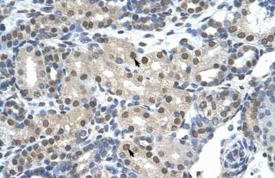 Immunohistochemistry-Paraffin: SNRP70 Antibody [NBP1-57487]
