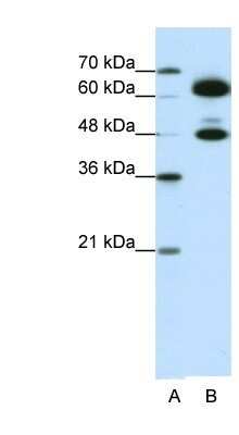 Western Blot: SNRP70 Antibody [NBP1-57455]