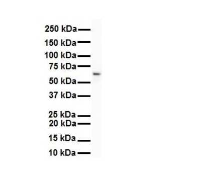 Western Blot: SNRP70 Antibody [NBP1-57455]