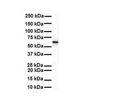 Western Blot: SNRP70 Antibody [NBP1-57455]