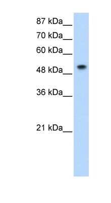 Western Blot: SNRP70 Antibody [NBP1-57487]