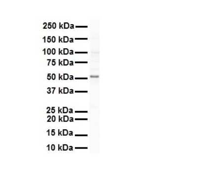 Western Blot: SNRP70 Antibody [NBP1-57487]