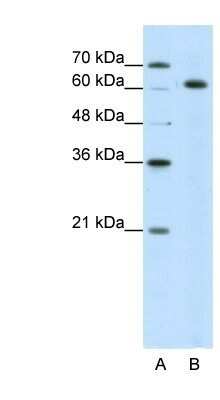 Western Blot: SNRP70 Antibody [NBP1-57488]