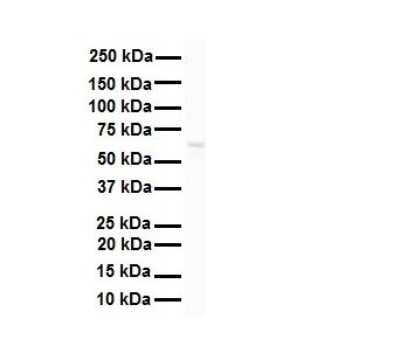Western Blot: SNRP70 Antibody [NBP1-57488]