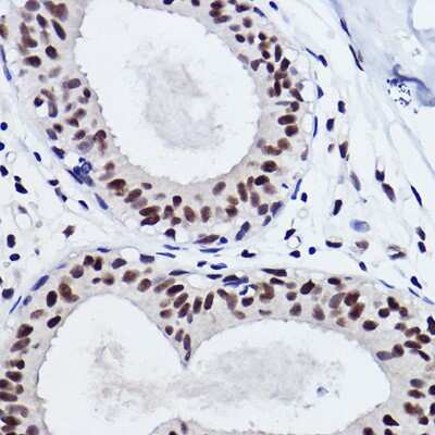Immunohistochemistry-Paraffin: SNRPA1 Antibody (2D7M1) [NBP3-15292]