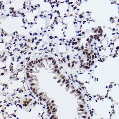 Immunohistochemistry-Paraffin: SNRPA1 Antibody (2D7M1) [NBP3-15292]