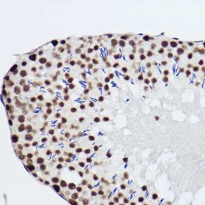 Immunohistochemistry-Paraffin: SNRPA1 Antibody (2D7M1) [NBP3-15292]