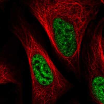 Immunocytochemistry/ Immunofluorescence: SNRPA1 Antibody [NBP2-33447]