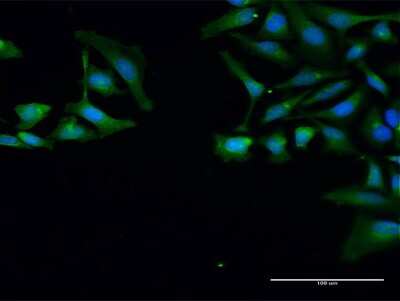 Immunocytochemistry/ Immunofluorescence: SNRPB Antibody [H00006628-D01P]