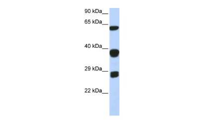 Western Blot: SNRPB Antibody [NBP1-57237]
