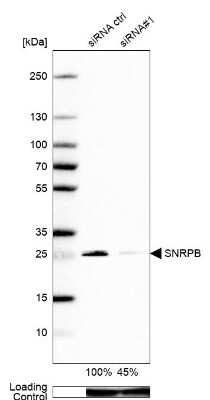 Knockdown Validated: SNRPB Antibody [NBP2-56420]
