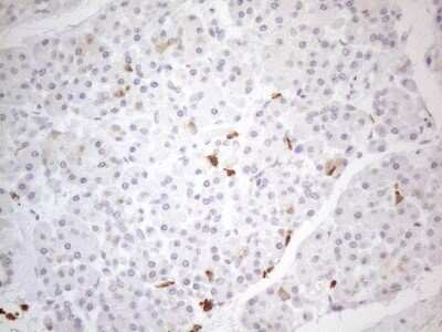 Immunohistochemistry: SNRPB2 Antibody (OTI2A5) [NBP2-45893]