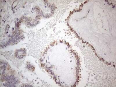 Immunohistochemistry: SNRPB2 Antibody (OTI2A5) [NBP2-45893]