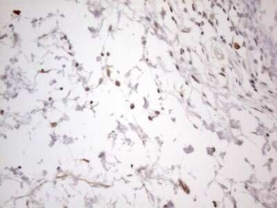 Immunohistochemistry: SNRPB2 Antibody (OTI2A5) [NBP2-45893]