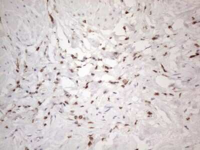 Immunohistochemistry: SNRPB2 Antibody (OTI2A5) [NBP2-45893]