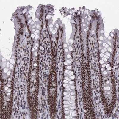 Immunohistochemistry: SNRPB2 Antibody [NBP2-69013]