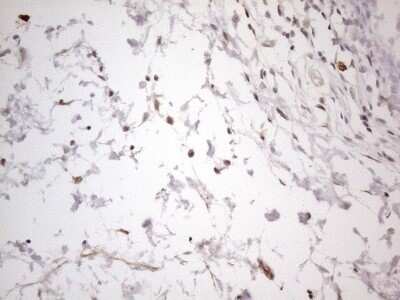 Immunohistochemistry: SNRPB2 Antibody (OTI2A5) - Azide and BSA Free [NBP2-74260]