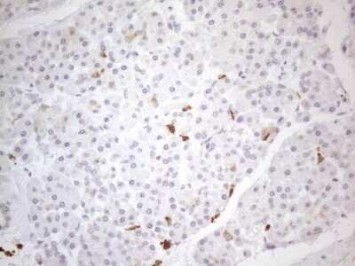 Immunohistochemistry: SNRPB2 Antibody (OTI2A5) - Azide and BSA Free [NBP2-74260]