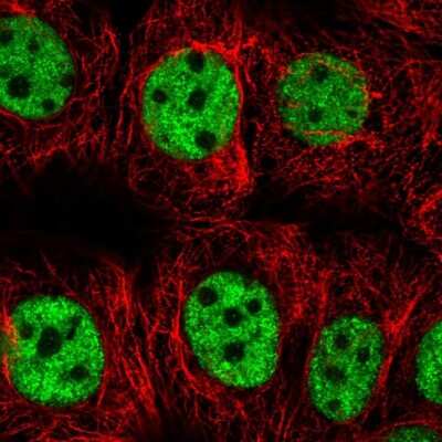 Immunocytochemistry/ Immunofluorescence: SNRPC Antibody [NBP2-38755]
