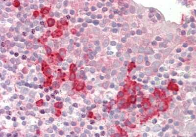 Immunohistochemistry-Paraffin: SNRPD1 Antibody [NBP2-83569]