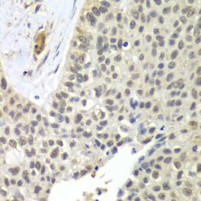 Immunohistochemistry-Paraffin: SNRPD2 Antibody - BSA Free [NBP2-95236]