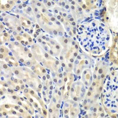 Immunohistochemistry-Paraffin: SNRPD2 Antibody - BSA Free [NBP2-95236]